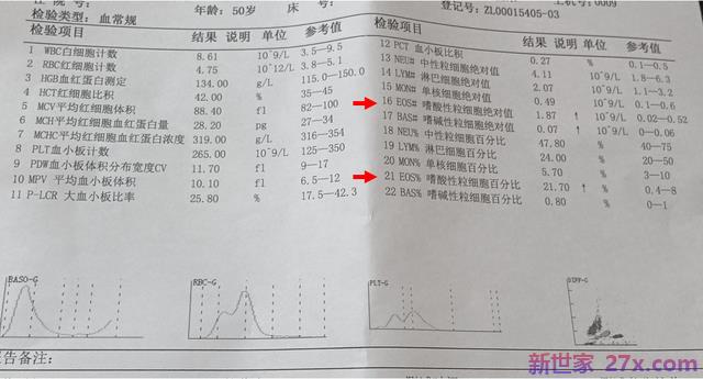 哮喘患者为什么要注意嗜酸性粒细胞的数量？