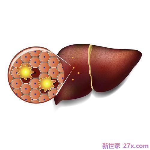 最近身体总有7个异常，大部分都是脂肪肝要来的征兆。不要当真！